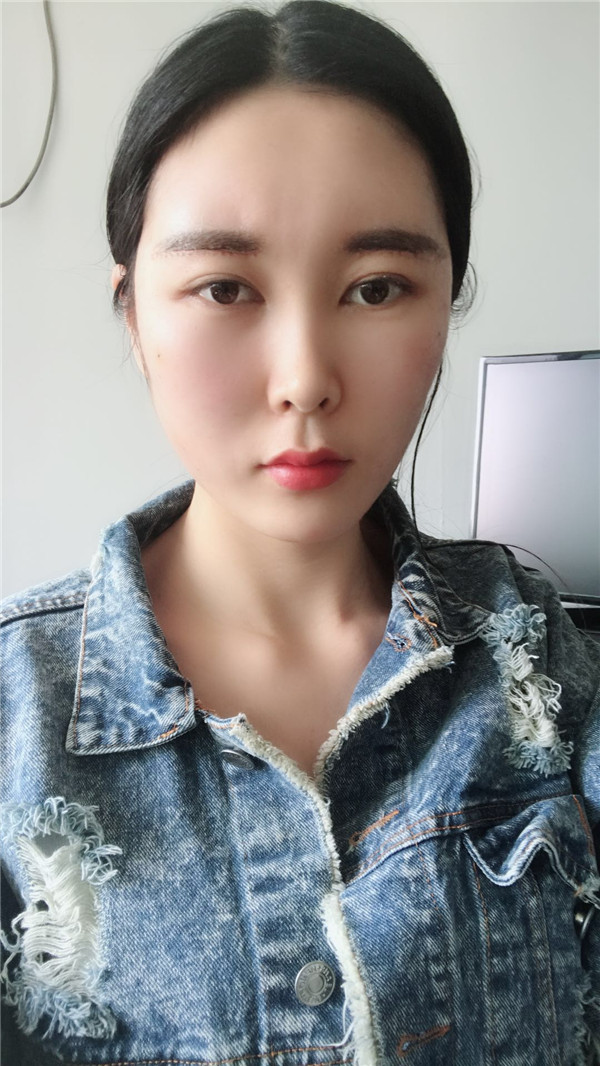 武汉华美付国友脂肪填充怎么样?价格案例