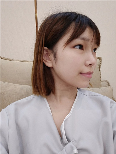 青岛伊美尔刘长发眼部综合怎么样?价格案例分享