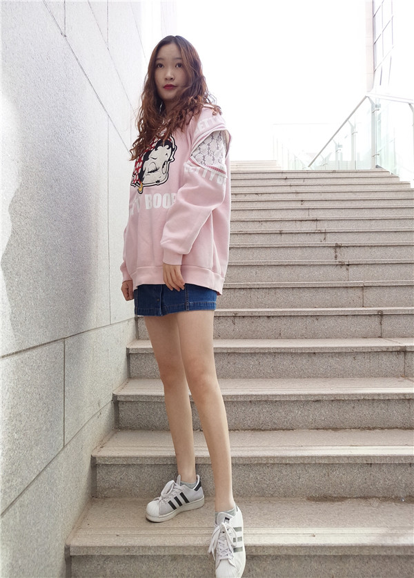 石家庄贵美人吸脂怎么样？价格案例111天