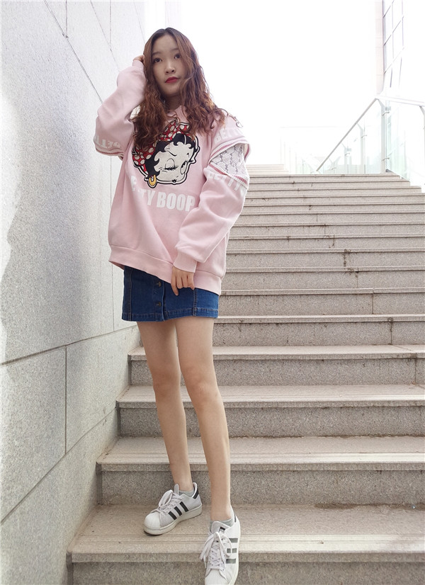 石家庄贵美人吸脂怎么样？价格案例111天