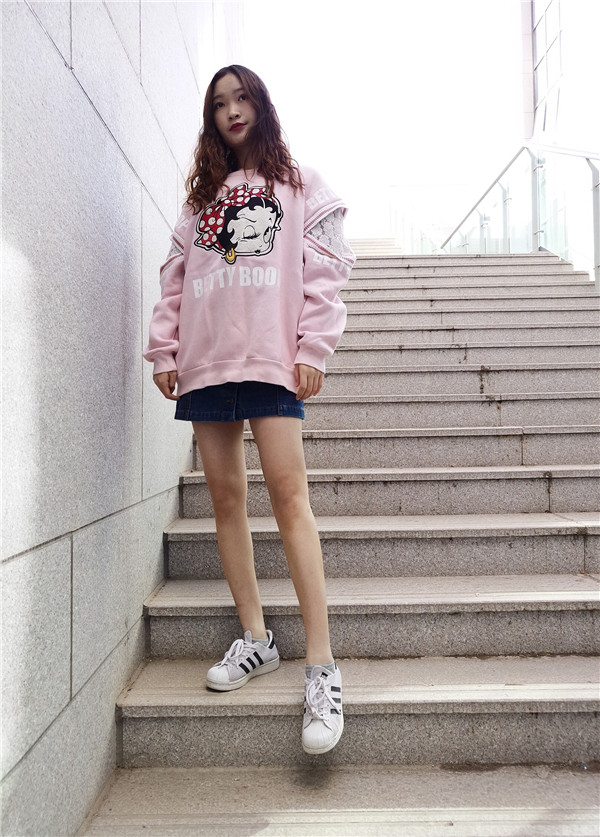 石家庄贵美人吸脂怎么样？价格案例111天