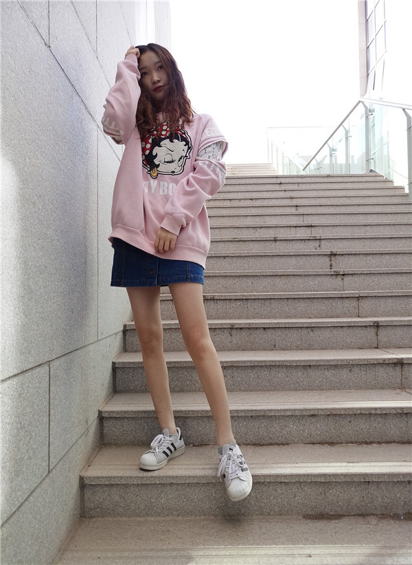 石家庄贵美人吸脂怎么样？价格案例111天