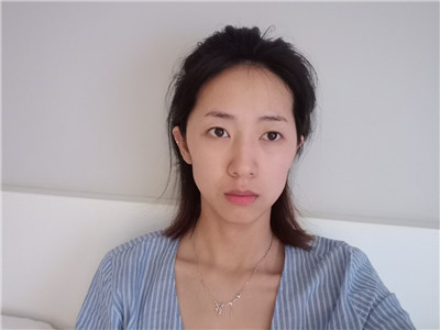 南京荟百颜张群自体脂肪全脸填充怎么样?案例分享