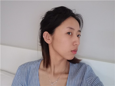 南京荟百颜张群自体脂肪全脸填充怎么样?案例分享