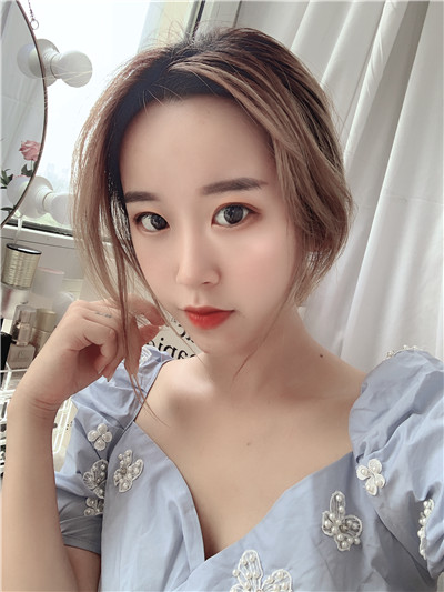 杭州港丽曹飞超面部吸脂怎么样?案例分享