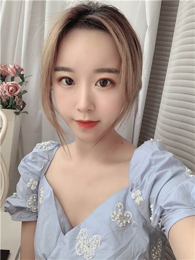 杭州港丽曹飞超面部吸脂怎么样?案例分享