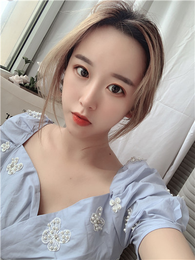 杭州港丽曹飞超面部吸脂怎么样?案例分享