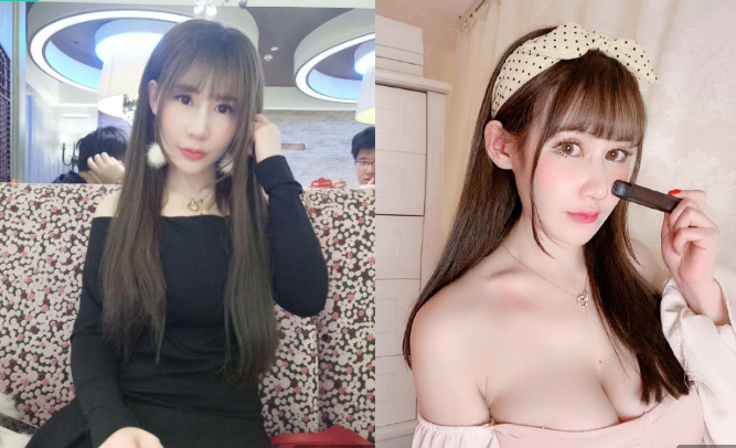 北京润美玉之光朱金成自体脂肪隆胸怎么样?案例果