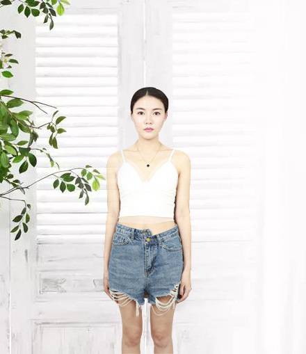 福州爱美尔张胜利隆胸怎么样?案例,价格,口碑