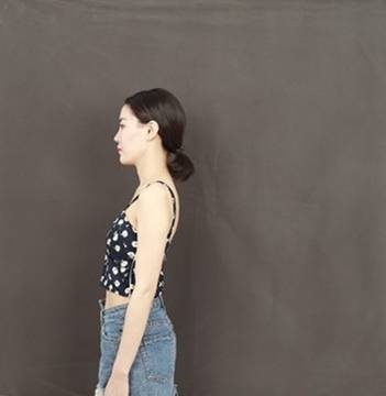 福州爱美尔张胜利隆胸怎么样?案例,价格,口碑