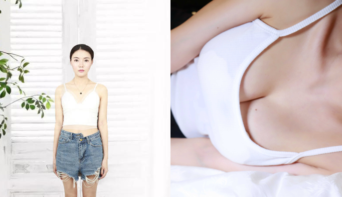 福州爱美尔张胜利隆胸怎么样?案例,价格,口碑