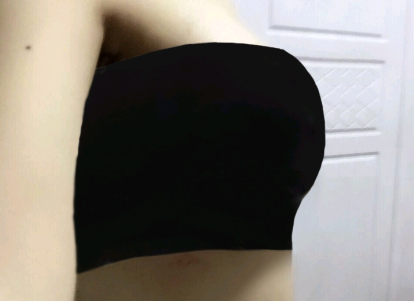 北京艺星王英勇隆胸怎么样?案例,价格,口碑
