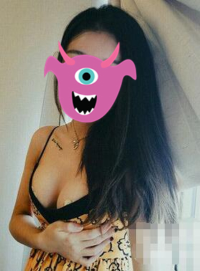 广州壹加壹张红艳隆胸怎么样?案例,价格,口碑