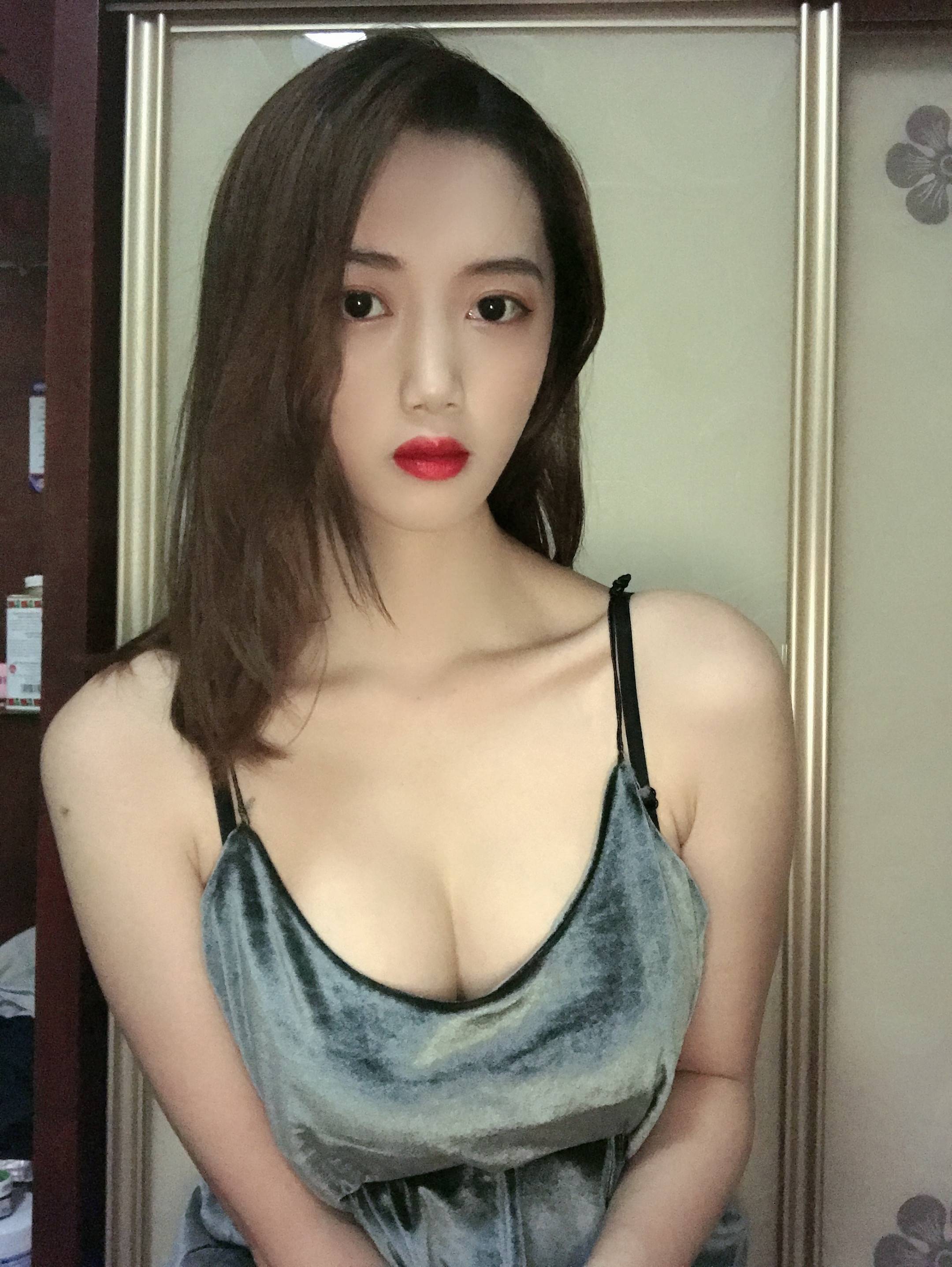 哈尔滨雅美吴谦隆胸怎么样?案例,价格,口碑