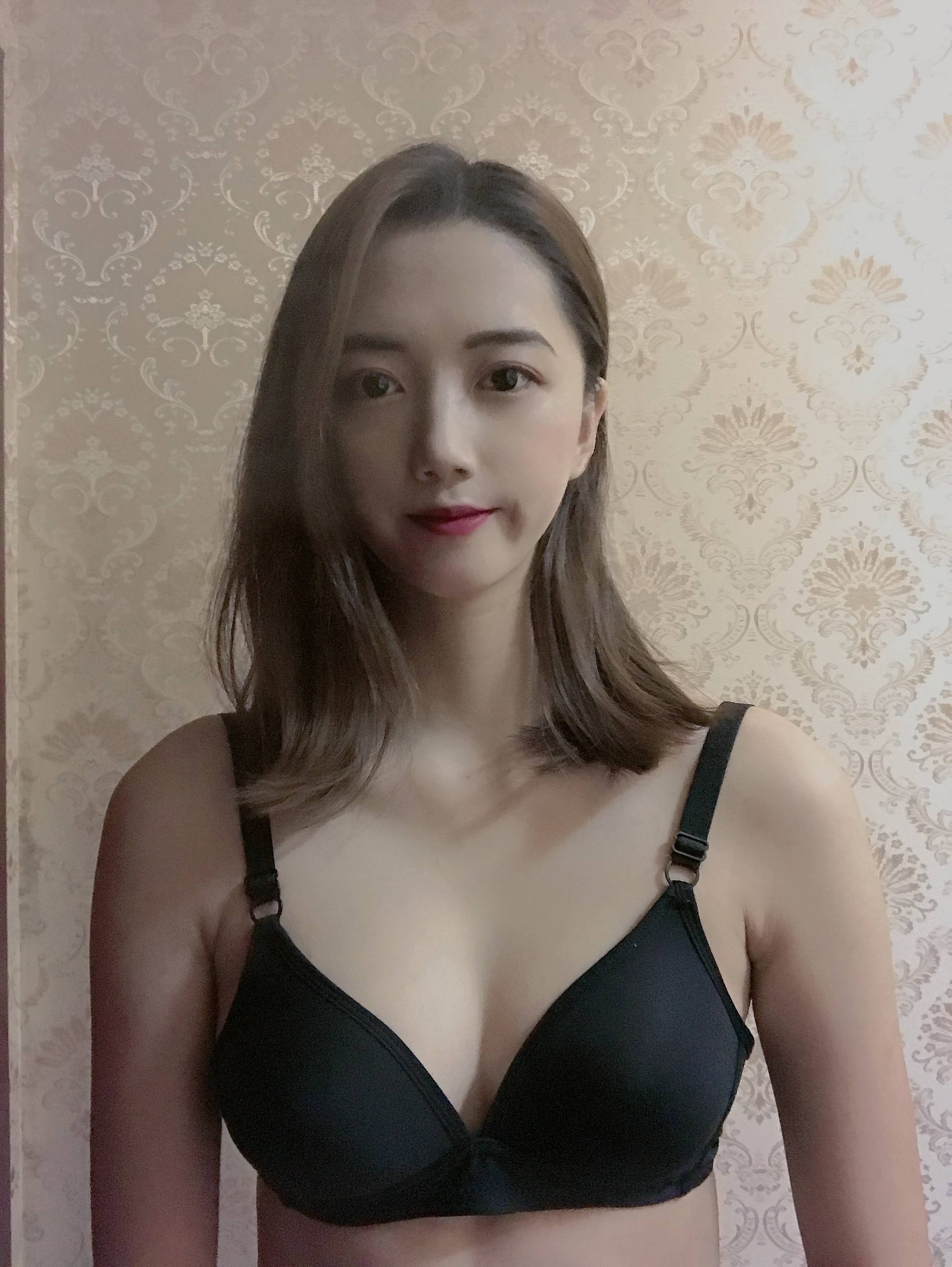 哈尔滨雅美吴谦隆胸怎么样?案例,价格,口碑