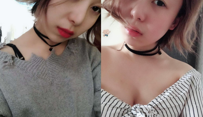 北京叶子李明隆胸怎么样?案例,价格,口碑