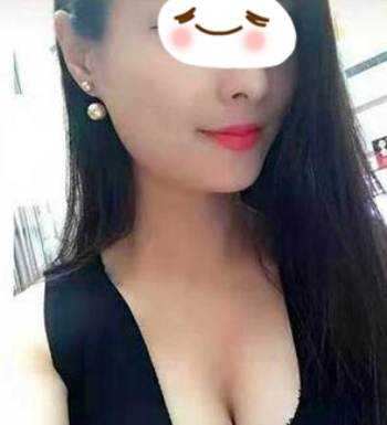 北京艾玛丁小邦隆胸怎么样?案例,价格,口碑