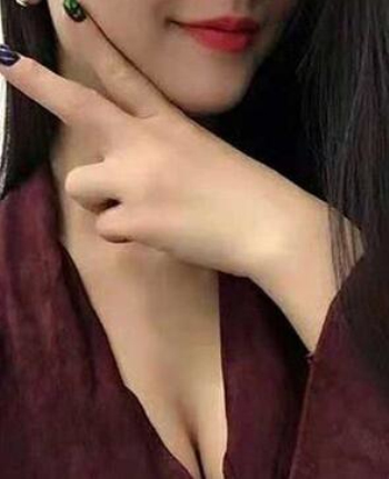 北京艾玛丁小邦隆胸怎么样?案例,价格,口碑