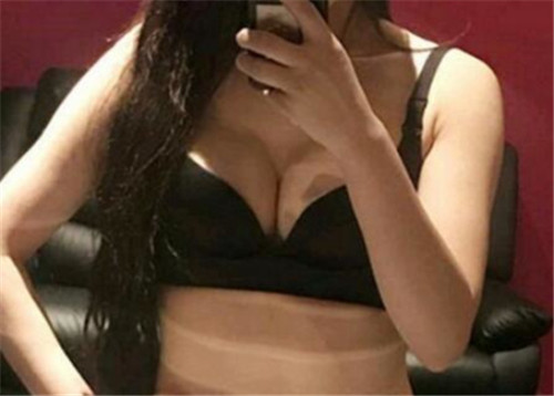 上海美希李攀隆胸怎么样?案例,价格,口碑
