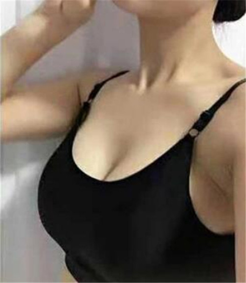 北京美莱王志军隆胸怎么样?案例,价格,口碑
