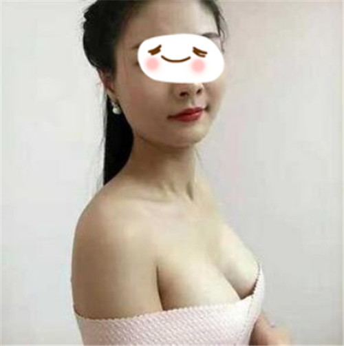 北京美莱王志军隆胸怎么样?案例,价格,口碑