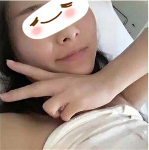 北京美莱王志军隆胸怎么样?案例,价格,口碑