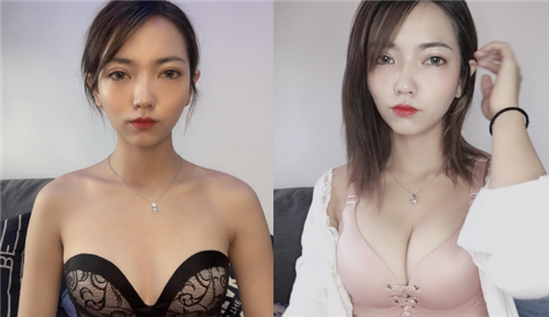 上海伊莱美李湘源隆胸怎么样?案例,价格,口碑