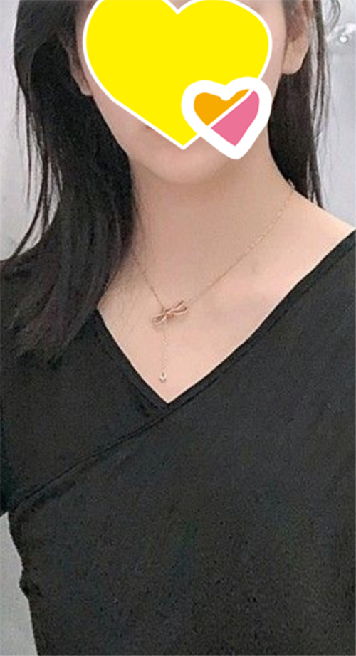 上海艺星唐毅隆胸怎么样?案例,价格,口碑