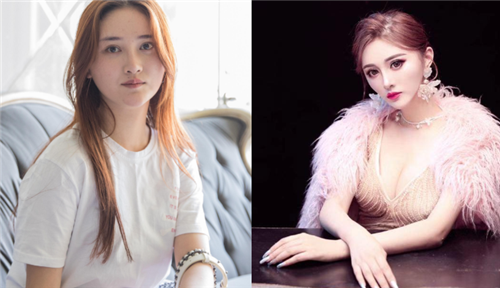 上海时光张晶隆胸怎么样?案例,价格,口碑