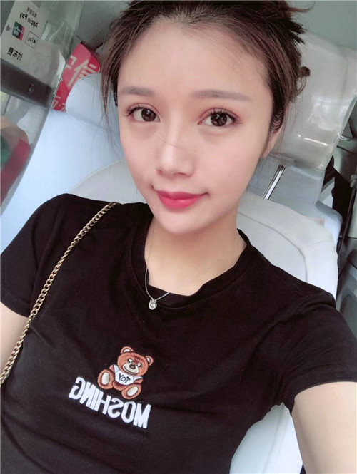 上海艺星彭才学隆胸怎么样?案例,价格,口碑