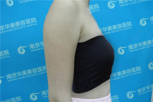 南京华美沈正宇隆胸怎么样?案例,价格,口碑