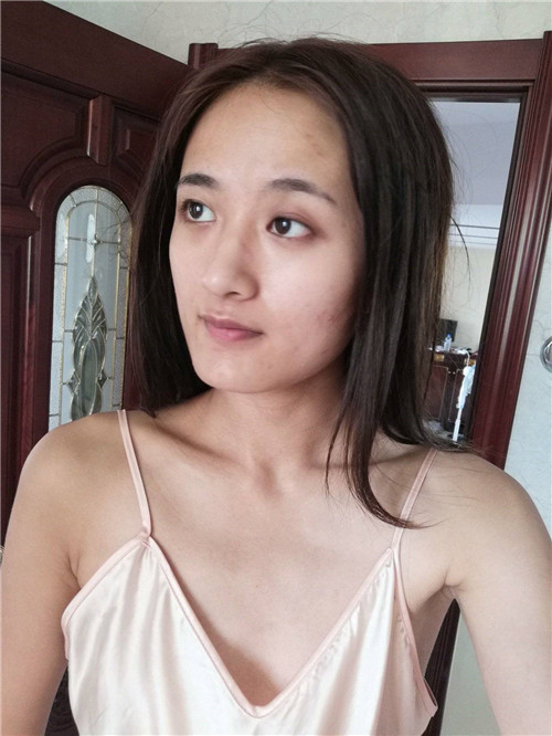 北京韩啸崔志燮隆胸怎么样?案例,价格,口碑