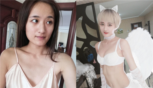 北京韩啸崔志燮隆胸怎么样?案例,价格,口碑