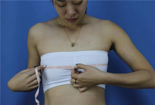 上海伊莱美李旭东隆胸怎么样?案例,价格,口碑