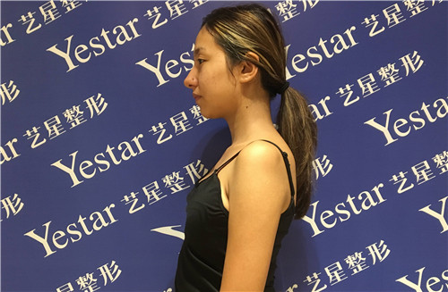 北京艺星翟红宇隆胸怎么样?案例,价格,口碑