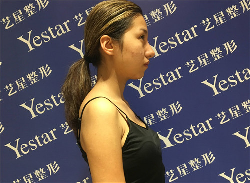 北京艺星翟红宇隆胸怎么样?案例,价格,口碑