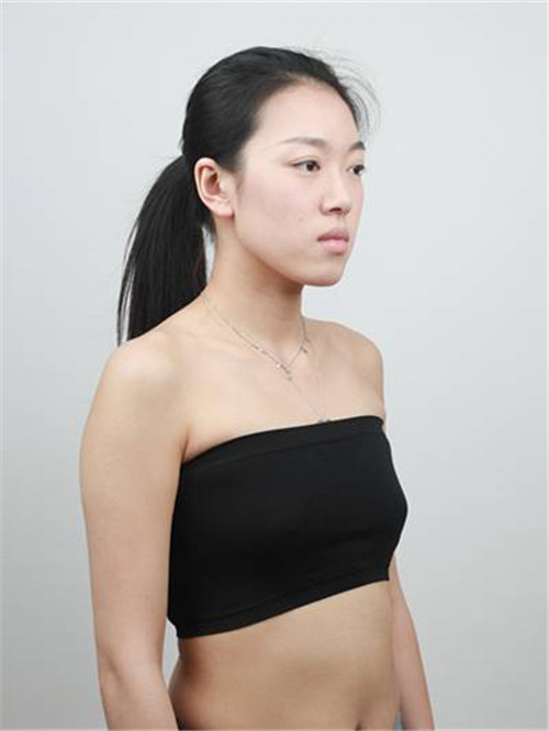 上海美希李攀丰胸怎么样?案例,价格,口碑