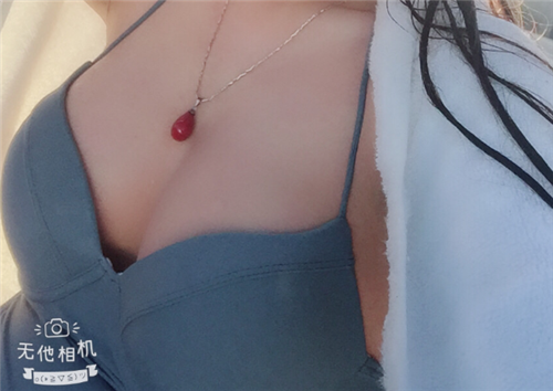 上海时光许黎平丰胸怎么样?案例_价格_口碑
