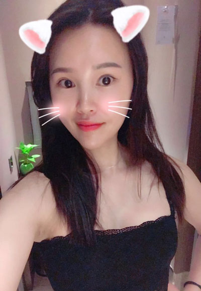 北京伟力嘉美信叶文珏自体脂肪移植怎么样?案例_价格_口碑