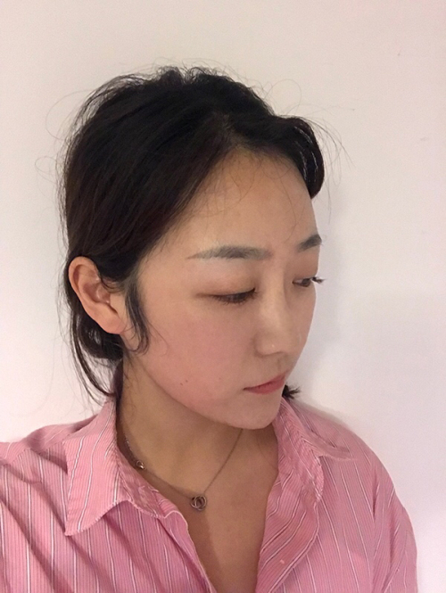 北京画美徐学东做鼻子怎么样?案例_价格_口碑