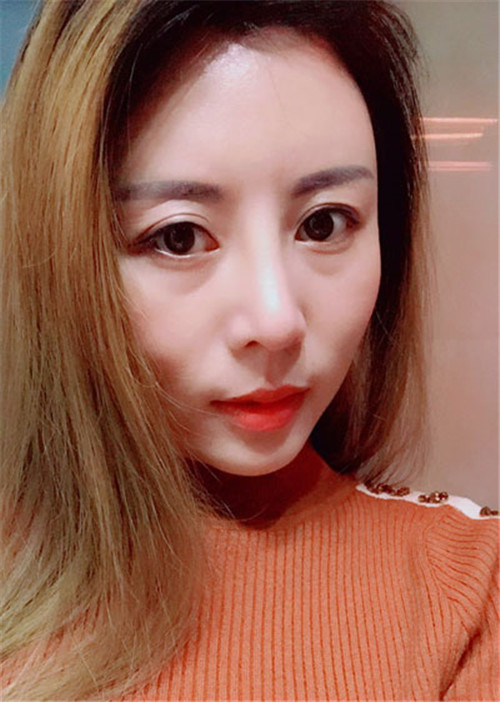 上海华美叶丽萍做鼻子怎么样?案例_价格_口碑