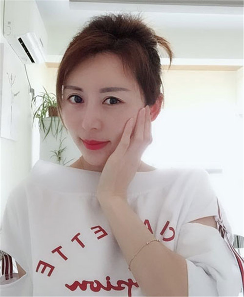 上海华美叶丽萍做鼻子怎么样?案例_价格_口碑