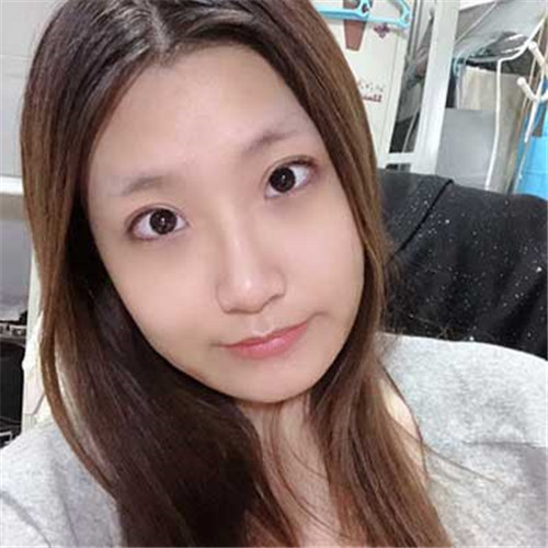 上海美希杨清建抽脂怎么样?案例_价格_口碑