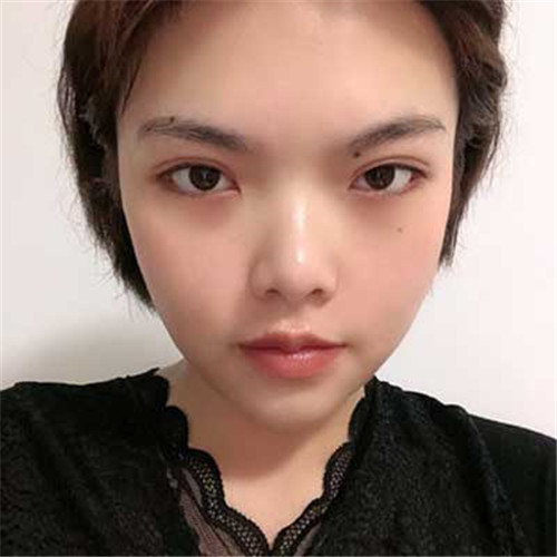 上海时光李静林隆胸怎么样?案例_价格_口碑