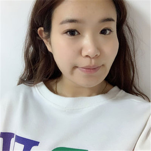 陈斌做鼻子怎么样?案例_价格_口碑