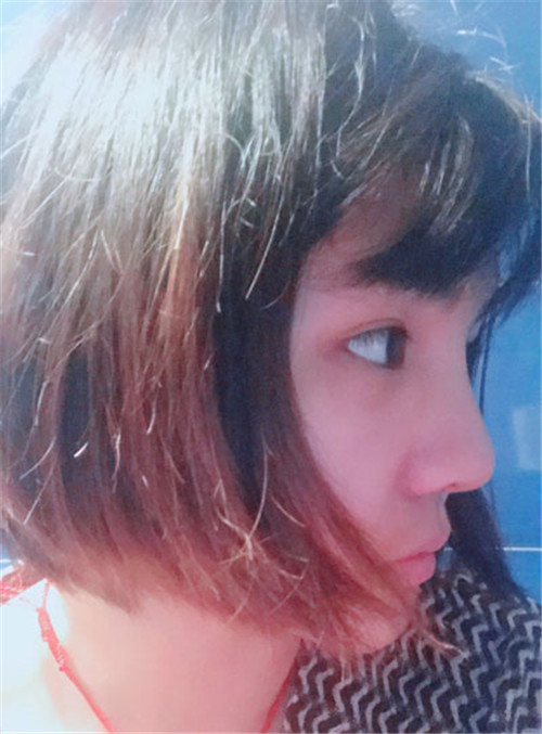 北京京民靳玉彪做鼻子怎么样?案例_价格_口碑