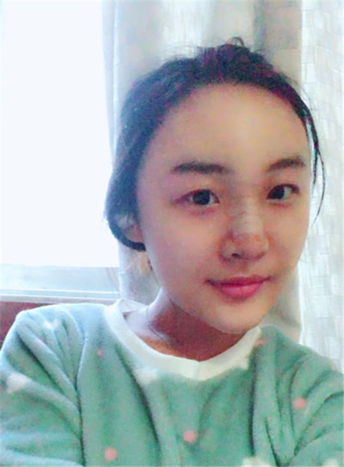 陈斌做鼻子怎么样,案例_价格_口碑