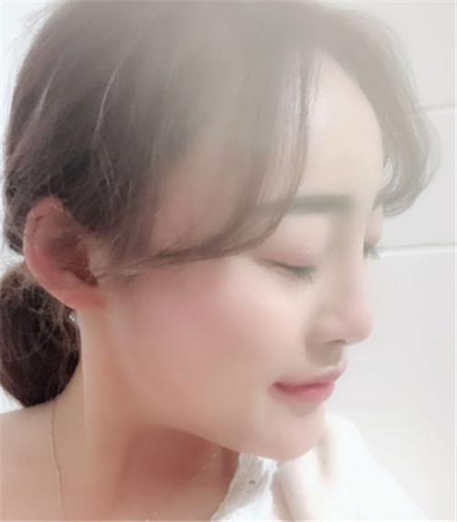 陈斌做鼻子怎么样,案例_价格_口碑