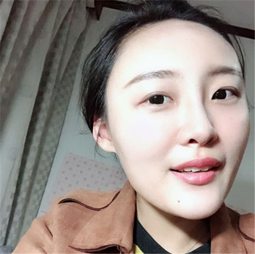 陈斌做鼻子怎么样,案例_价格_口碑