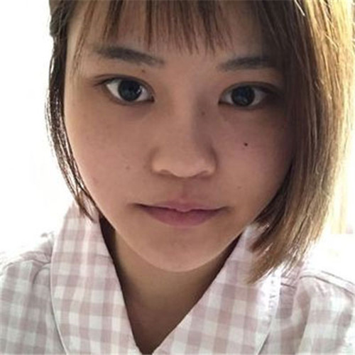 上海华美李健隆鼻怎么样?案例,价格_口碑